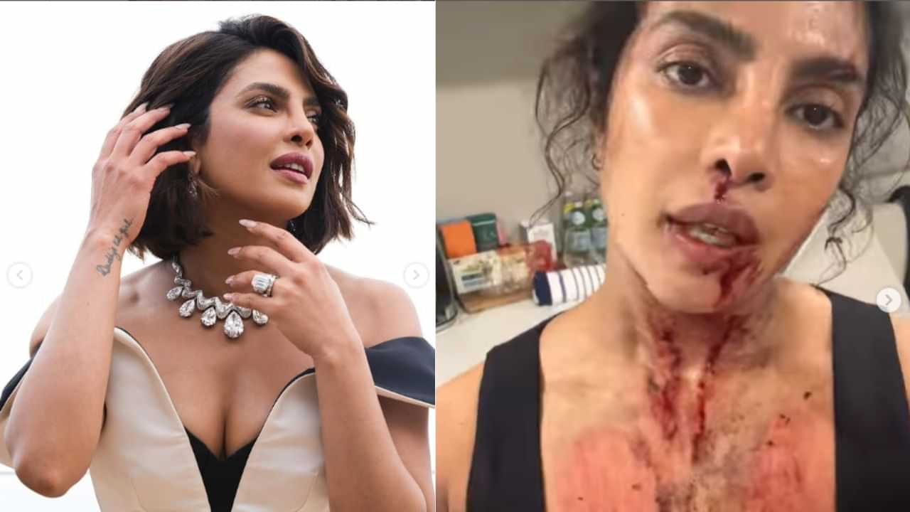 Priyanka Chopra: இரத்த கறைகளுடன் பிரியங்கா சோப்ரா வெளியிட்ட வீடியோ - அதிர்ச்சியில் ரசிகர்கள்!