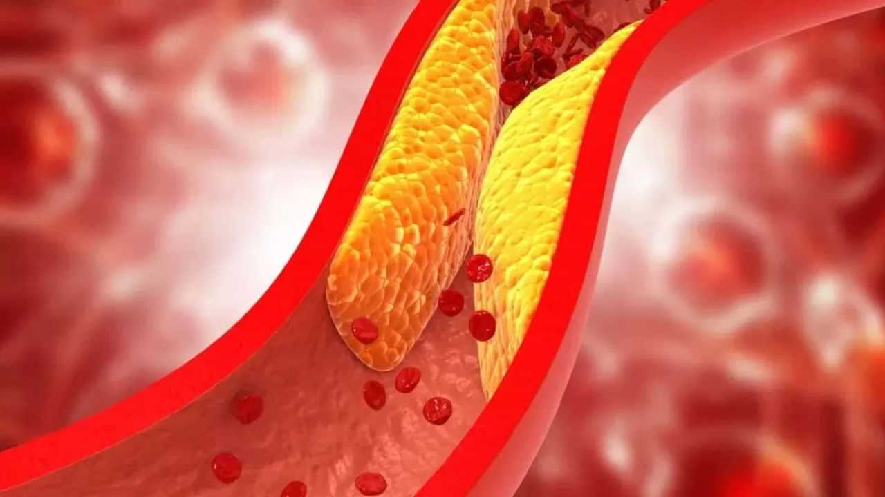 Cholesterol : கொலஸ்ட்ரால் சர்ரென குறையும்.. சூப்பரான 7 உணவுகள்