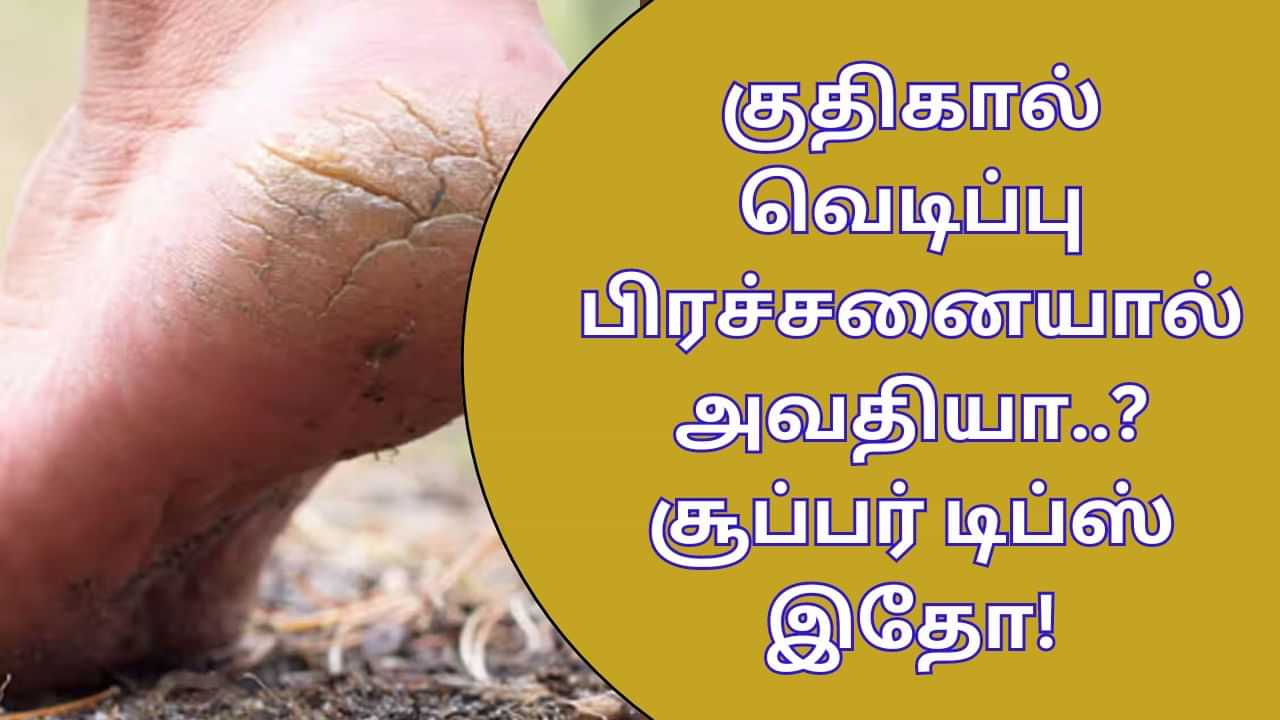 Cracked Heels: குதிகால் வெடிப்பு பிரச்சனையால் தினமும் அவதியா..? இந்த டிப்ஸ் ட்ரை பண்ணுங்க!