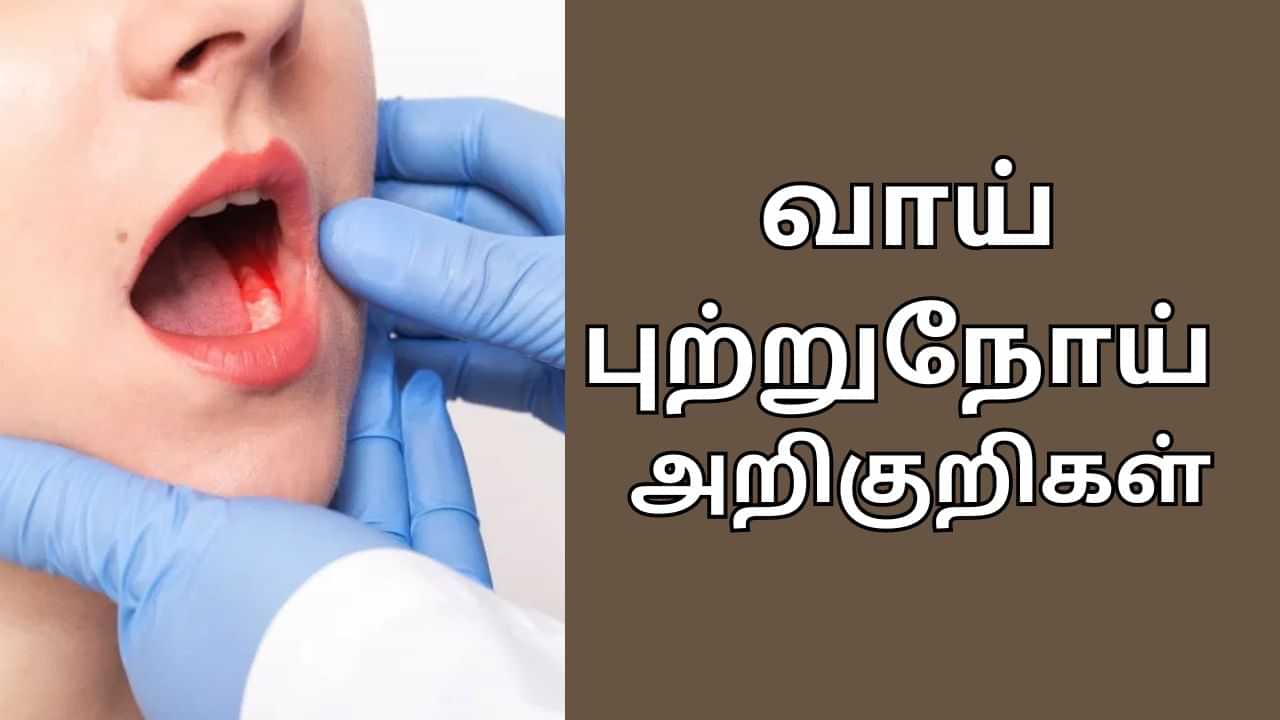 Oral Cancer: இதெல்லாம் இருந்தா வாய் புற்றுநோய்க்கான அறிகுறிகள்.. உடனே ஹாஸ்பிட்டல் போங்க..!