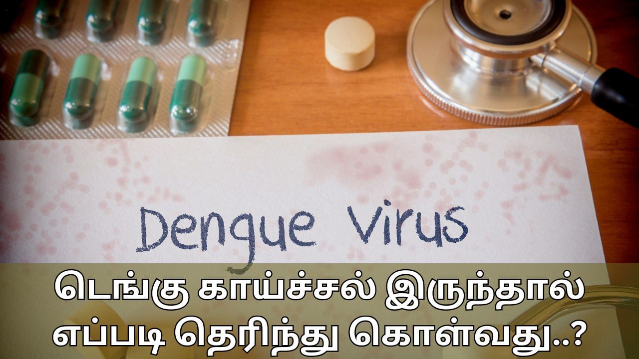 Dengue: உங்களுக்கு டெங்கு இருந்தால் எப்படி தெரிந்து கொள்வது..? அறிகுறிகள் என்ன..?