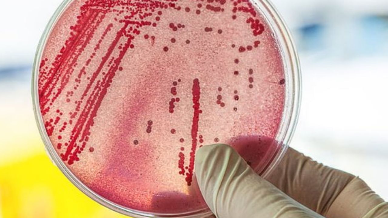 E Coli Bacteria: சென்னை குடிநீரில் 75% E Coli பாக்டீரியா.. ஐஐடி ஆய்வில் சொன்ன பகீர் தகவல்.. எப்படி பாதுகாத்துக்கொள்வது?