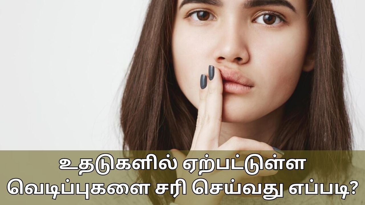 பருவ மாற்றத்தால் உதடுகளில் வெடிப்பா..? சரிசெய்ய எளிய குறிப்புகள் இதோ!