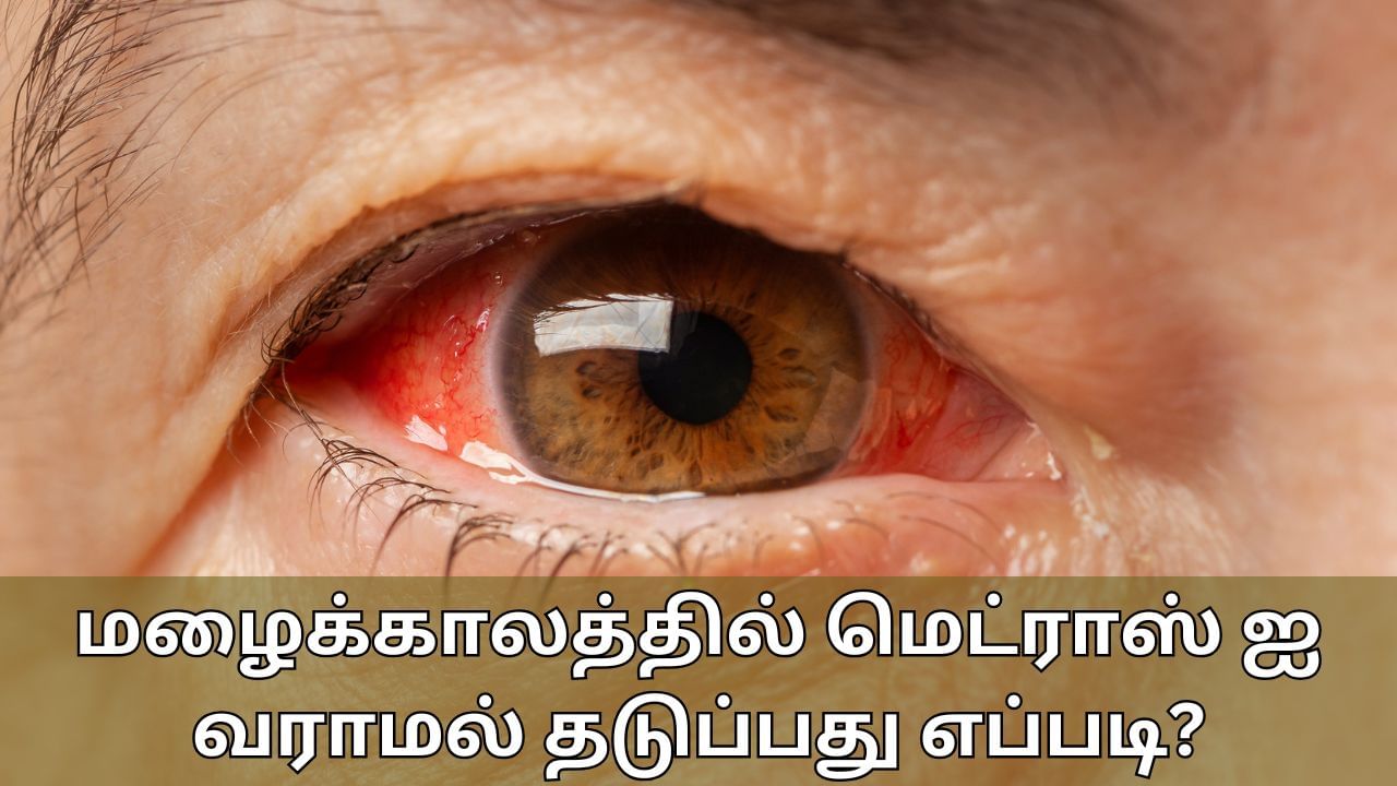 Conjunctivitis: மழைக்காலத்தில் அதிகரிக்கும் மெட்ராஸ் ஐ..! கண்களை பாதிக்காமல் தடுப்பது எப்படி?