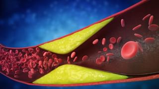 Cholesterol: உடலில் கெட்ட கொலஸ்ட்ரால் உள்ளதா..? உங்கள் பாதங்களை கொண்டே அறியலாம்..!