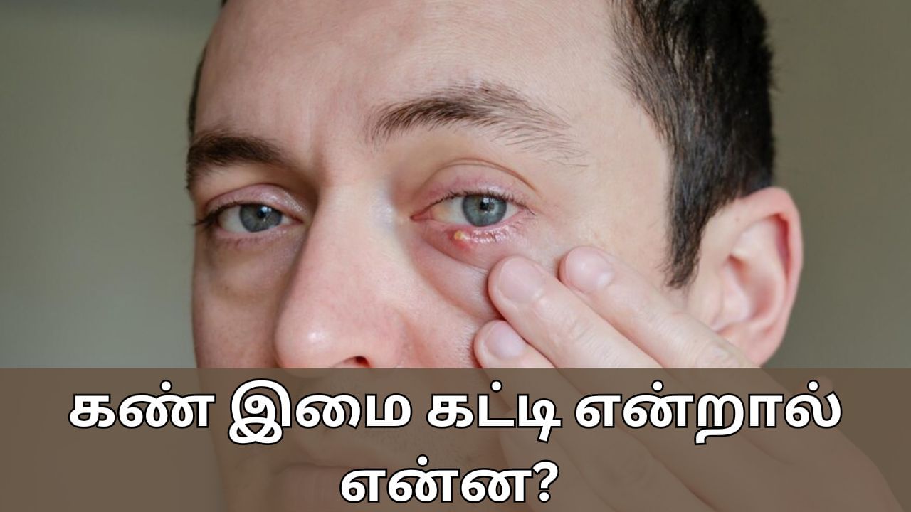 Chalazion: கண் இமை மீது சிவப்பு நிற கட்டியா..? இது ஏன் உருவாகிறது தெரியுமா..?