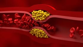 Cholesterol: கொலஸ்ட்ராலை குறைக்க வேண்டுமா..? இந்த 5 உணவுப்பொருட்கள் உதவும்!