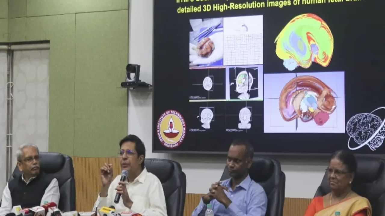 3D Brain Maps: உலகிலேயே முதன்முறை.. மனித மூளையின் 3D படங்களை வெளியிட்ட ஐஐடி மெட்ராஸ்!